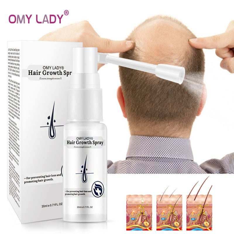 omy lady anti hair loss / hair growth spray for men women